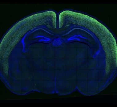 Human-specific genes, cortical development, and brain evolution.