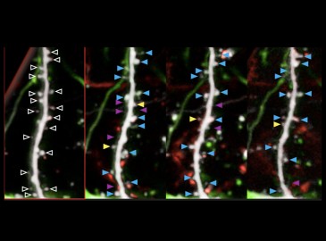 Mechanisms controlling the timing of human neuronal development: human brain neoteny.
