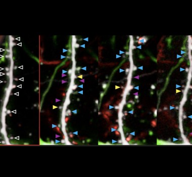 Mechanisms controlling the timing of human neuronal development: human brain neoteny.