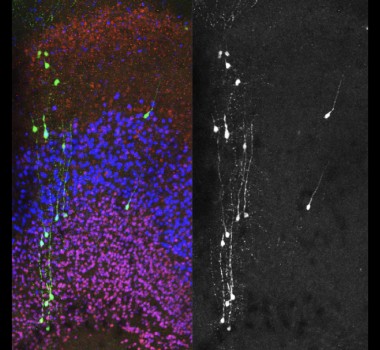 Modeling of neurodevelopmental disorders in human neurons in vivo.