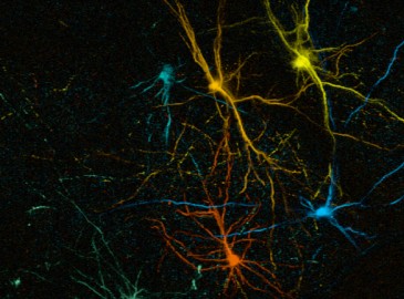 Function and plasticity of transplanted human neurons: from circuit development to brain repair.