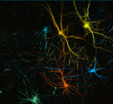 Function and plasticity of transplanted human neurons: from circuit development to brain repair.