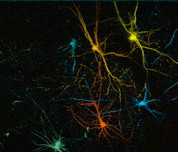gcamp-in-vivo-imaging-of-transplanted-human-neurons.jpg
